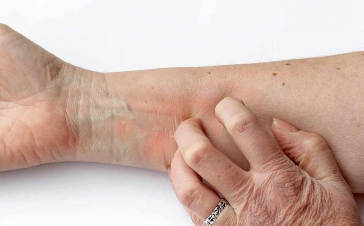 Neurodermitis svg+xml;charset=utf 8,<svg xmlns%3D'http%3A%2F%2Fwww.w3 - Neurodermitis