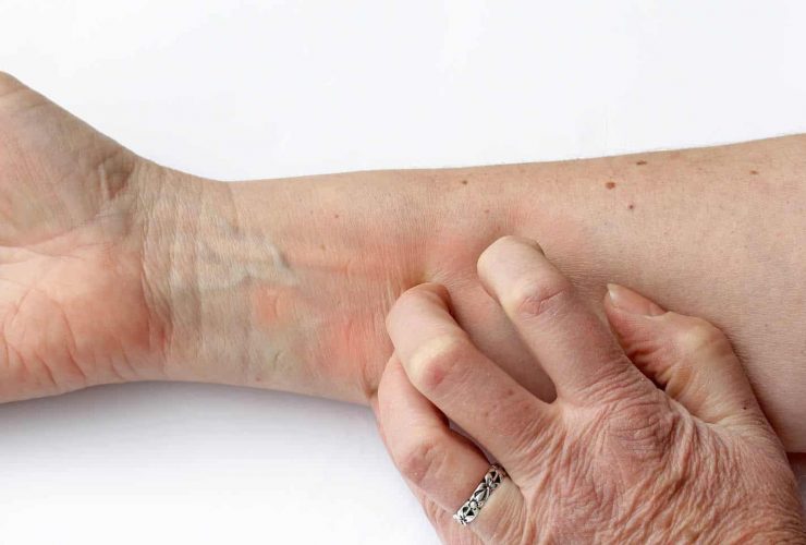 svg+xml;charset=utf 8,<svg xmlns%3D'http%3A%2F%2Fwww.w3 - Neurodermitis